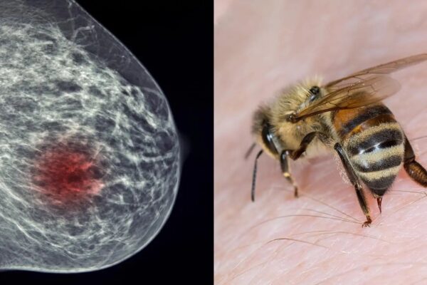 Research Suggests Honeybee Venom Can Destroy Certain Breast Cancer Cells in Under 60 Minutes