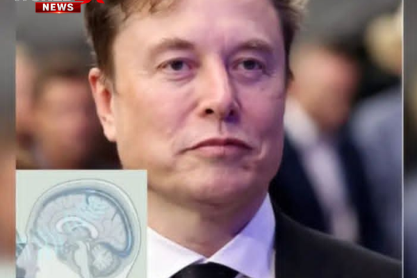 Elon Musk Says Future Brain Implant Technology Could Transform Human Abilities